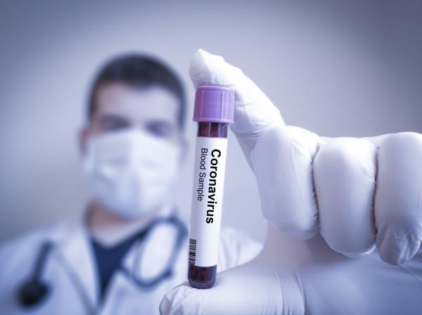 coronatest