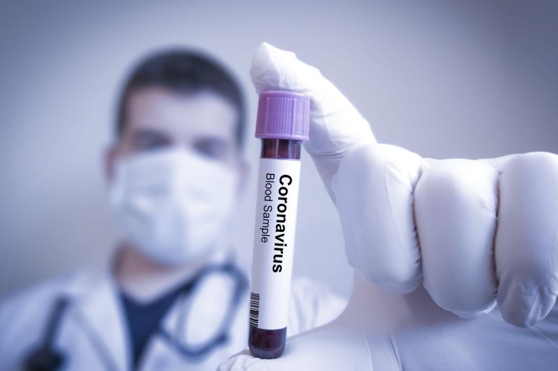 coronatest